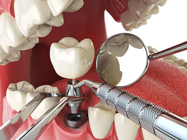 Best Emergency Dentist for Knocked-Out Tooth in York Harbor, ME